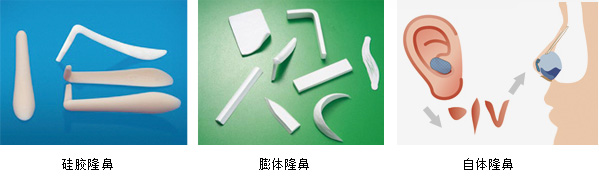 假体隆鼻